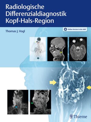 cover image of Radiologische Differenzialdiagnostik Kopf-Hals-Region
